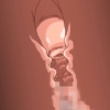 Thumbnail of related posts 178